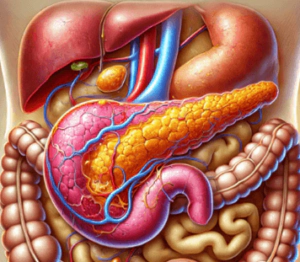 PANCREATITE